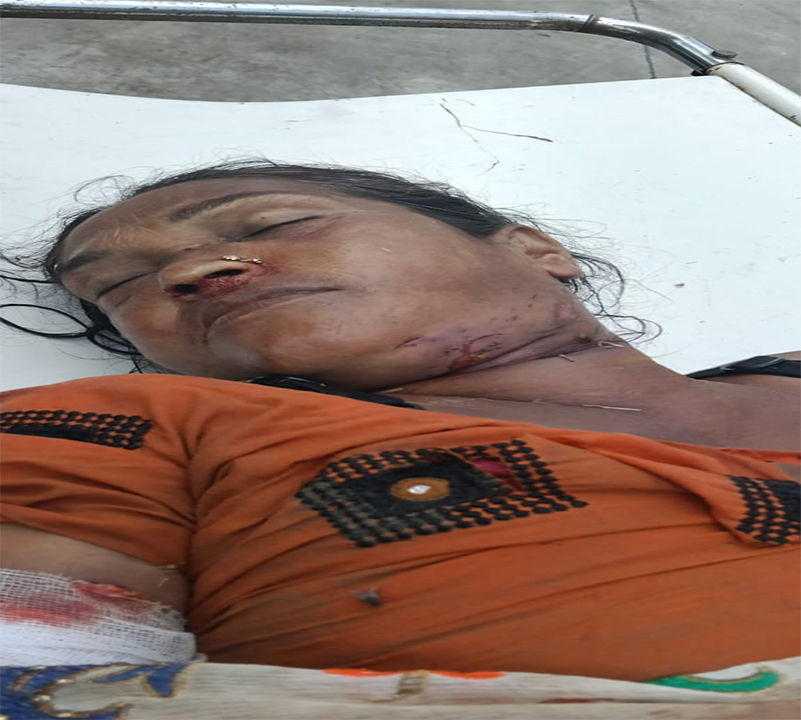 Bijnor Guldar Ke Hamle Me Mritak Mahila