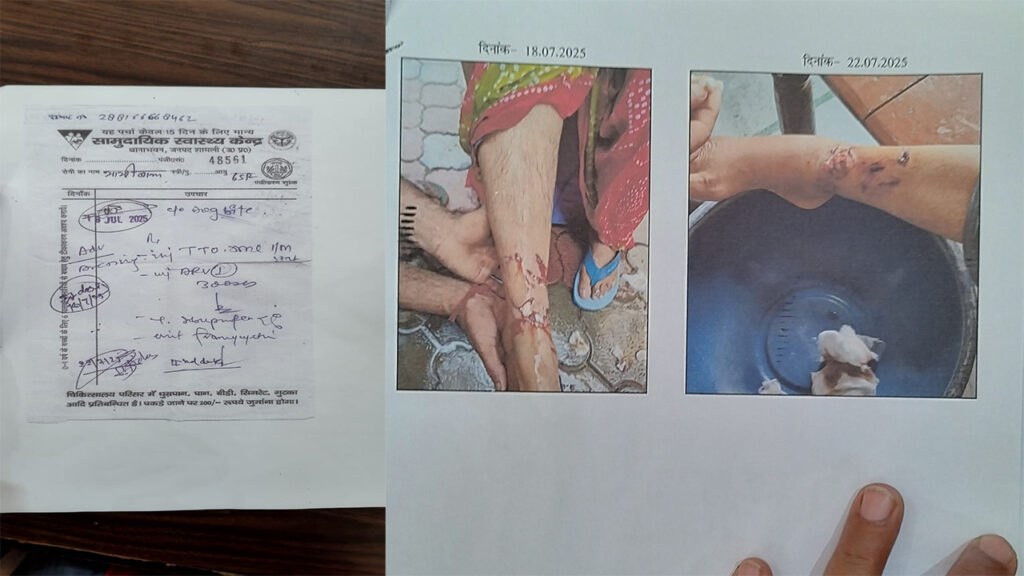 Shamli के सरकारी अस्पताल की लापरवाही से एयरफोर्स सैनिक की मां की मौत Shamli Ke Thana Bhawan Swasthya Kendra Ne Gambhirta Se Nahi Liya Iss Ghav Ko Jiske Chalte Mahila Ki mritu Ho Gayi