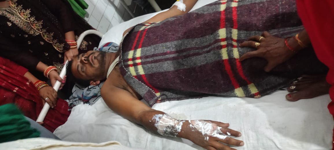 Current Lagne Se Buri Tarah Jhulsa Lineman (Bijnor)