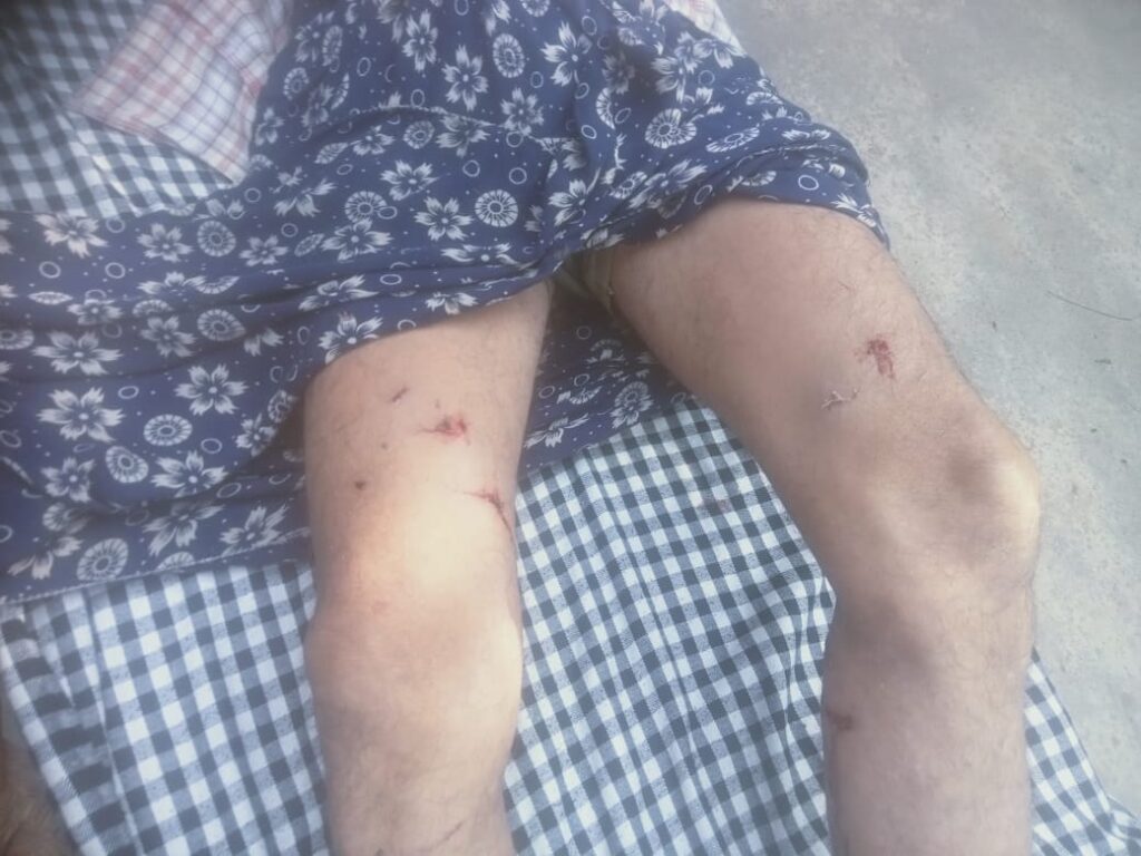 Hapur Me Bandaro Ka Aatank 55 Varhiy Vakeel Ghayal