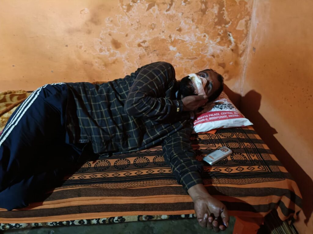 Hapur: लुहारी गांव में पागल बंदर का आतंक, तीन दिनों में 20 से अधिक लोग हुए शिकार Bandar Ke Hamle Se Ghayal Yuvak (Hapur)