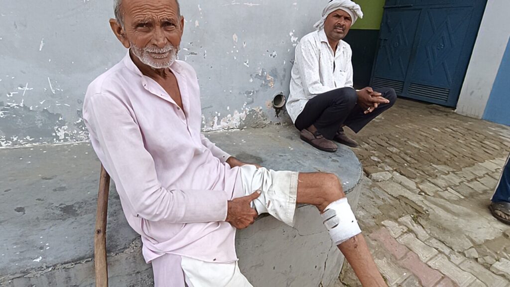 Hapur: लुहारी गांव में पागल बंदर का आतंक, तीन दिनों में 20 से अधिक लोग हुए शिकार Bandar Ne Hamle Se Ghayal Vridhh (Hapur)