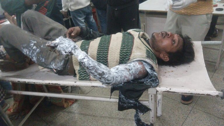 Sharab Ke Nashe Current Se Jhulsa Yuvak (Bijnor)